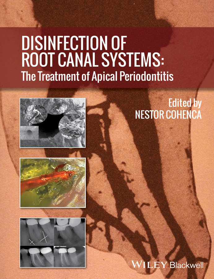 Disinfection of Root Canal Systems. The Treatment of Apical Periodontitis
