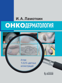 Обложка «Онкодерматология. Атлас»