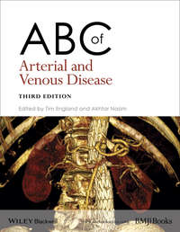 Обложка «ABC of Arterial and Venous Disease»