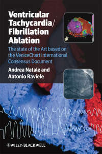 Обложка «Ventricular Tachycardia / Fibrillation Ablation. The state of the Art based on the VeniceChart International Consensus Document»