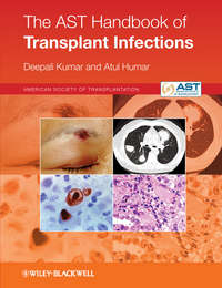 Обложка «The AST Handbook of Transplant Infections»