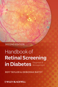 Обложка «Handbook of Retinal Screening in Diabetes. Diagnosis and Management»