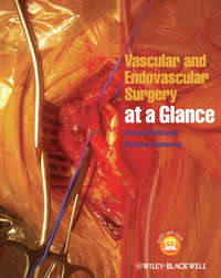 Обложка «Vascular and Endovascular Surgery at a Glance»