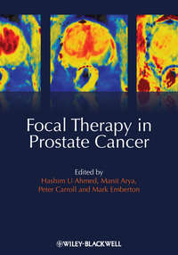 Обложка «Focal Therapy in Prostate Cancer»