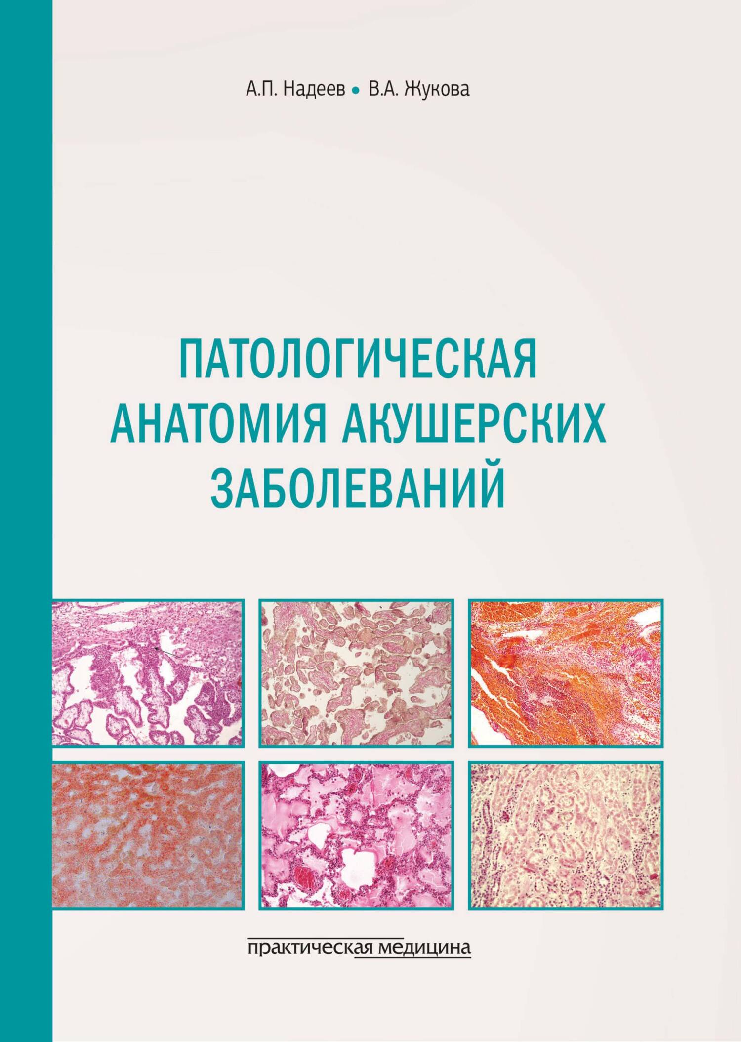 «Патологическая анатомия акушерских заболеваний» – А. П. Надеев | ЛитРес