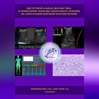 Инструментальная диагностика и мониторинг немедикаментозного лечения неалкогольной жировой болезни печени - Дарья Юрьевна Венидиктова