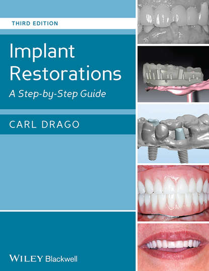 Implant Restorations. A Step-by-Step Guide (Carl  Drago). 