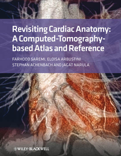 Revisiting Cardiac Anatomy. A Computed-Tomography-Based Atlas and Reference