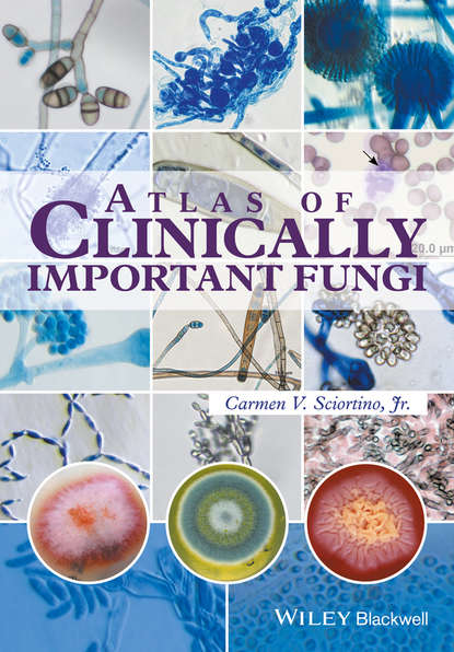 Atlas of Clinically Important Fungi - Carmen V. Sciortino, Jr.