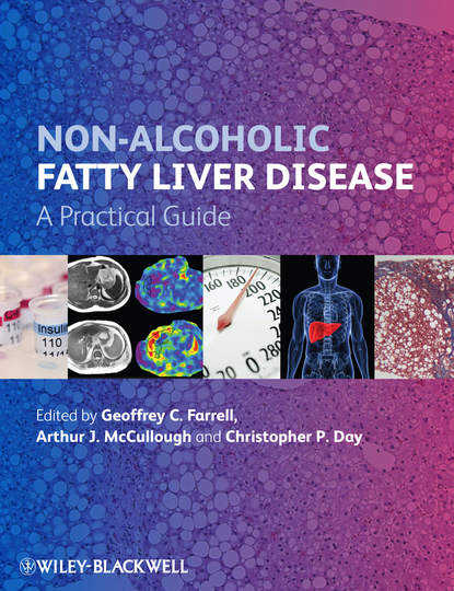 Non-Alcoholic Fatty Liver Disease - Группа авторов