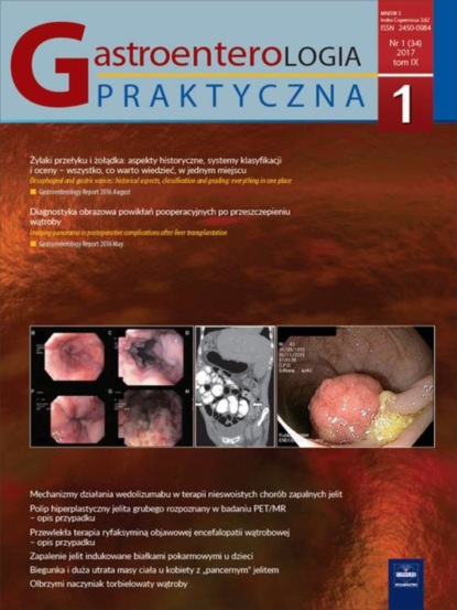 

Gastroenterologia Praktyczna 1/2017