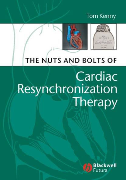 Группа авторов - The Nuts and Bolts of Cardiac Resynchronization Therapy