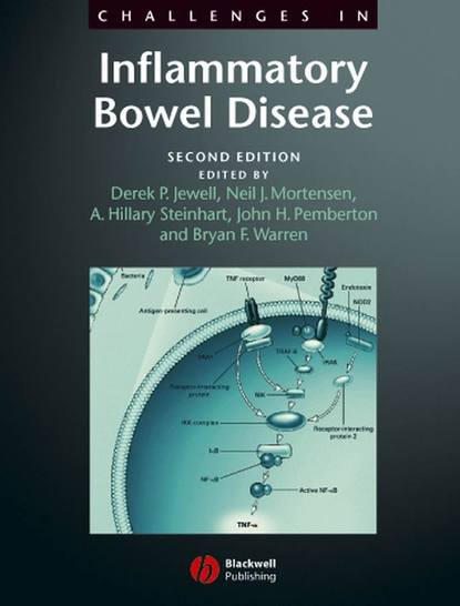 Challenges in Inflammatory Bowel Disease - Bryan Warren F.