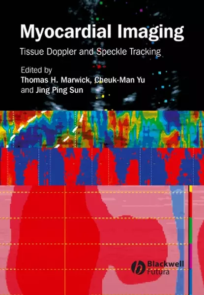 Обложка книги Myocardial Imaging, Cheuk-Man  Yu