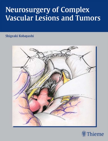 Группа авторов - Neurosurgery of Complex Vascular Lesions and Tumors