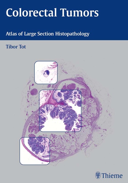 Tibor  Tot - Colorectal Tumors