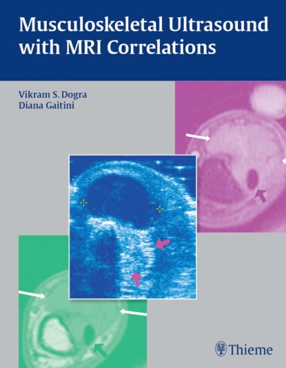 Группа авторов - Musculoskeletal Ultrasound with MRI Correlations