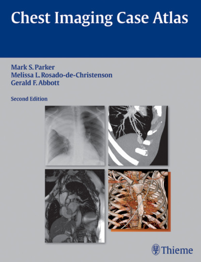 Mark S. Parker - Chest Imaging Case Atlas