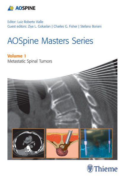 Ziya L. Gokaslan - AOSpine Masters Series Volume 1: Metastatic Spinal Tumors