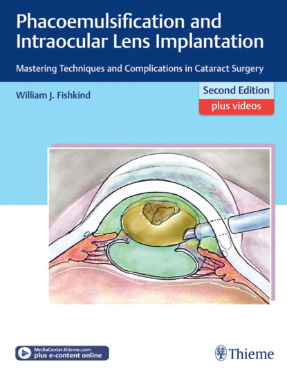 William J. Fishkind - Phacoemulsification and Intraocular Lens Implantation