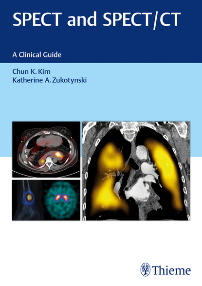 

SPECT and SPECT/CT