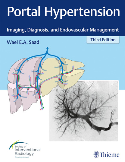 Wael E.A. Saad - Portal Hypertension