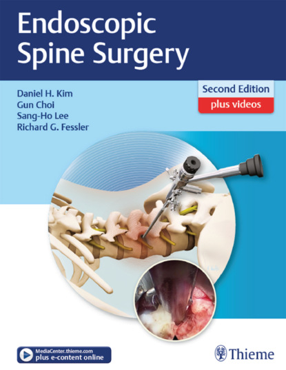 Группа авторов - Endoscopic Spine Surgery