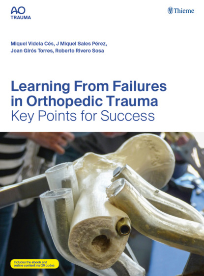 Группа авторов - Learning From Failures in Orthopedic Trauma