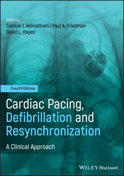 Cardiac Pacing, Defibrillation and Resynchronization - Группа авторов