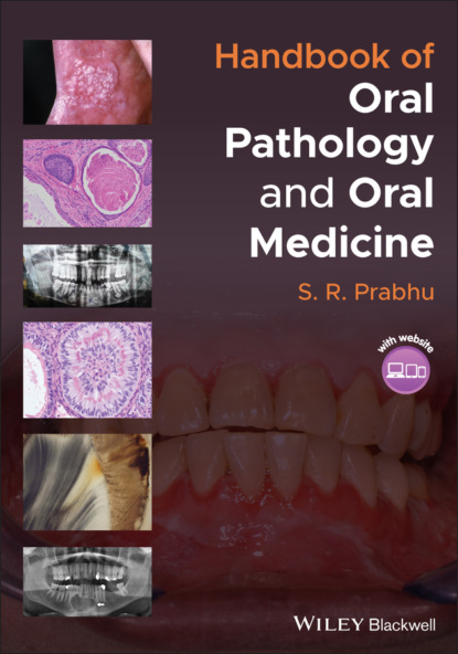 Handbook of Oral Pathology and Oral Medicine - S. R. Prabhu