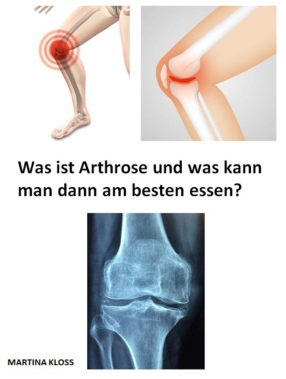 Was ist Arthrose und was kann man dann am besten essen?