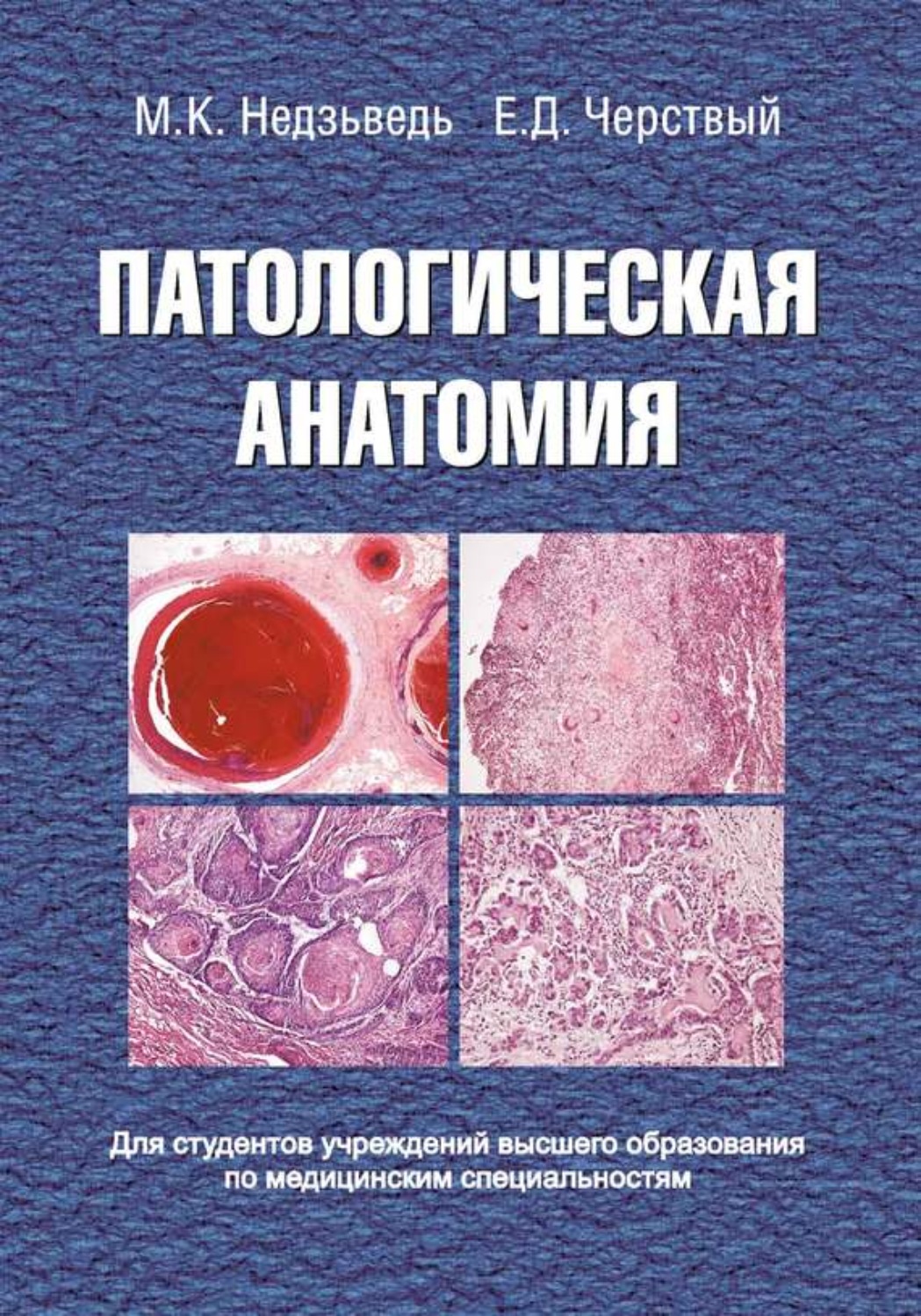 Альбом по патологической анатомии с рисунками