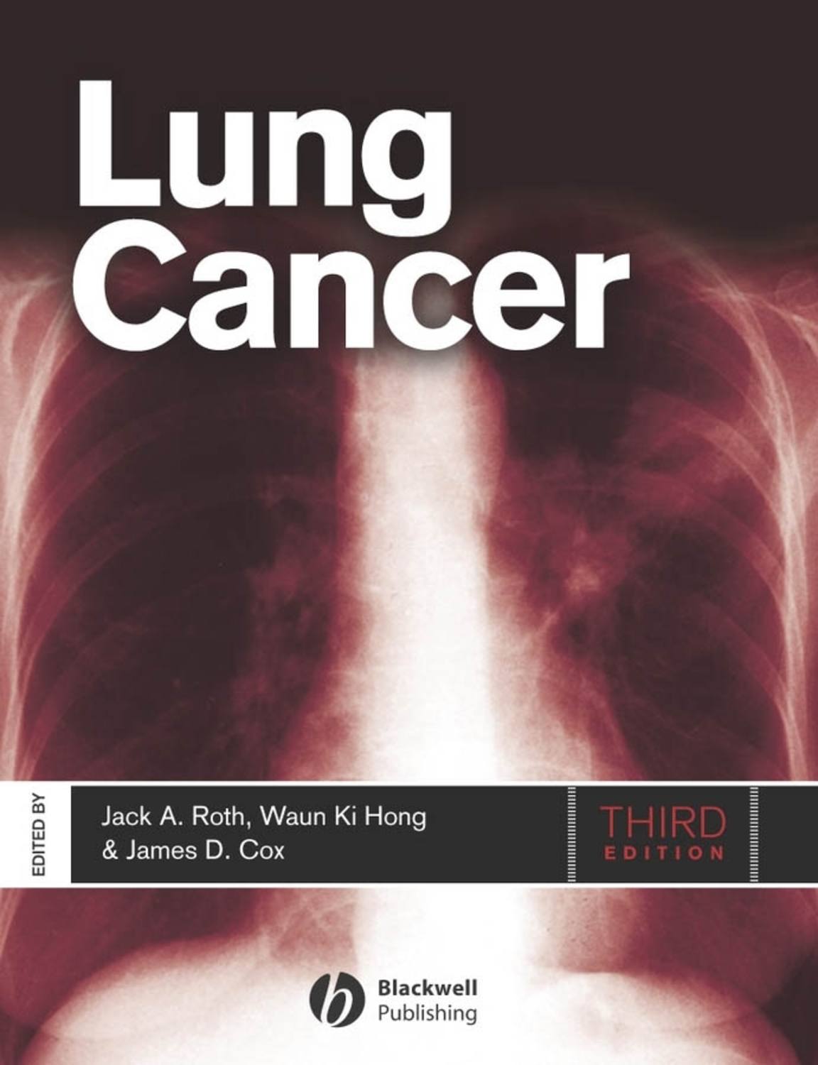 Книги про легкие. Jack Roth. Iron lung обложка. Книга lung-yuy. Three minutes for a Dog. My Life in an Iron lung книга.