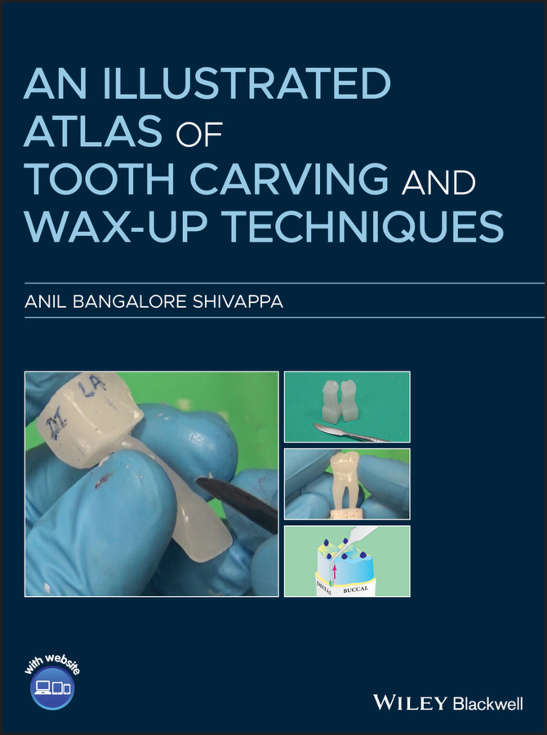 Anil Bangalore Shivappa, An Illustrated Atlas of Tooth Carving and Wax