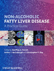 Non-Alcoholic Fatty Liver Disease