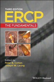 ERCP